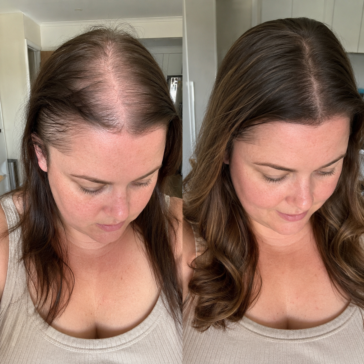 REGROW™ — Hair Replenishment