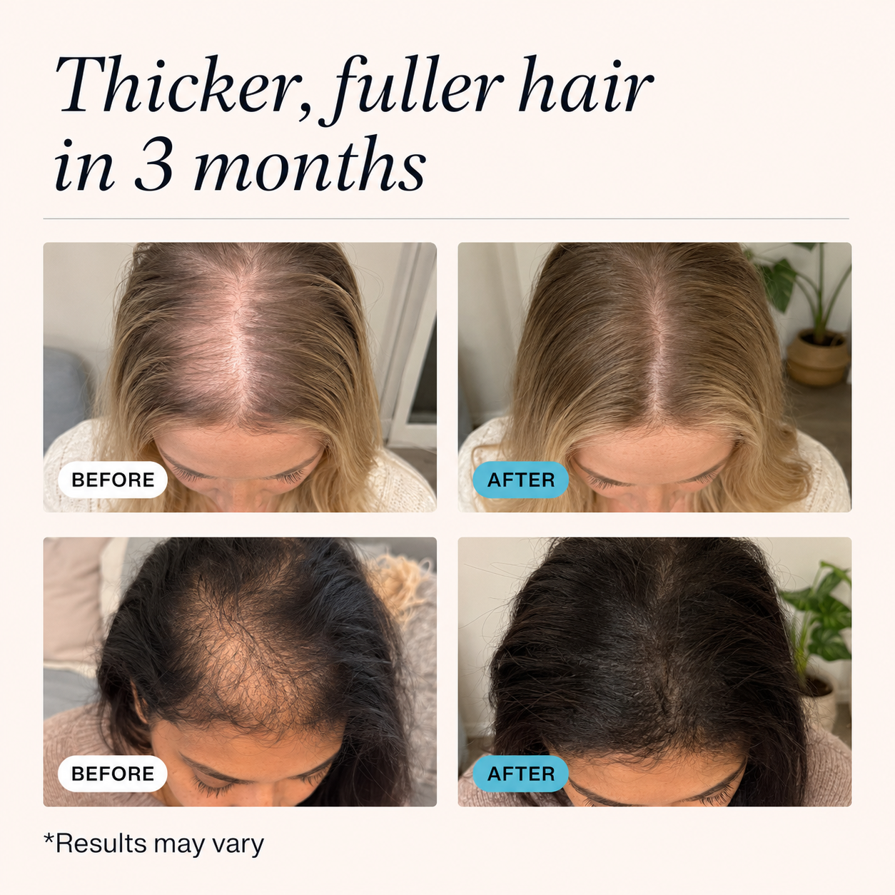 REGROW™ — Hair Replenishment