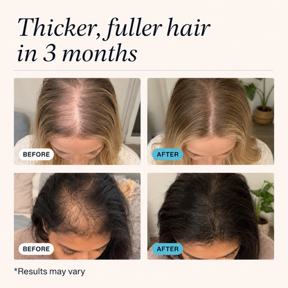 REGROW™ — Hair Replenishment